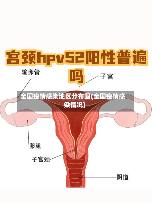 全国疫情感染地区分布图(全国疫情感染情况)-第2张图片