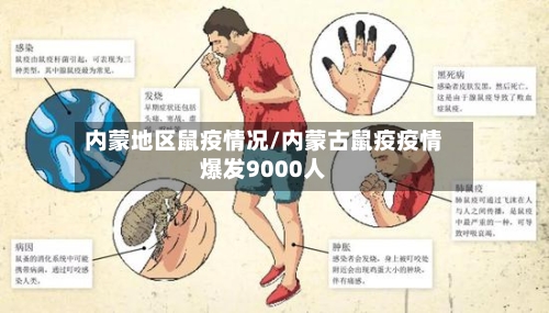 内蒙地区鼠疫情况/内蒙古鼠疫疫情爆发9000人