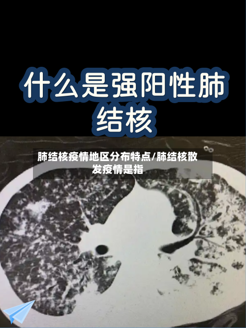 肺结核疫情地区分布特点/肺结核散发疫情是指