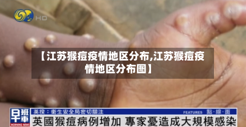 【江苏猴痘疫情地区分布,江苏猴痘疫情地区分布图】