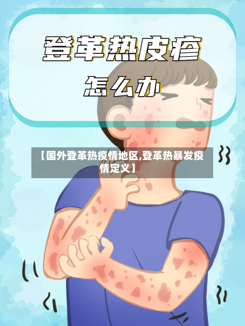 【国外登革热疫情地区,登革热暴发疫情定义】-第3张图片